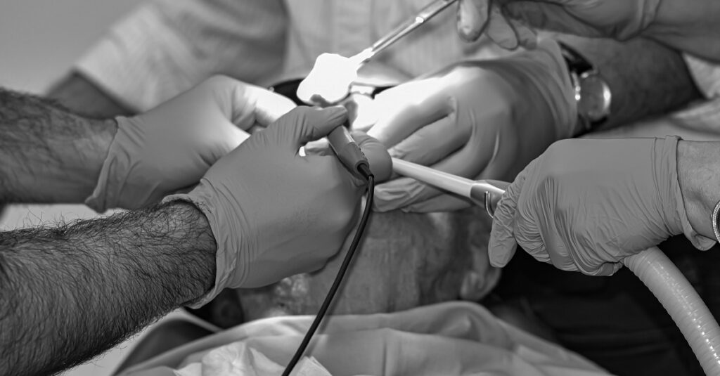 anesthesia, hospital, surgery-4607287.jpg